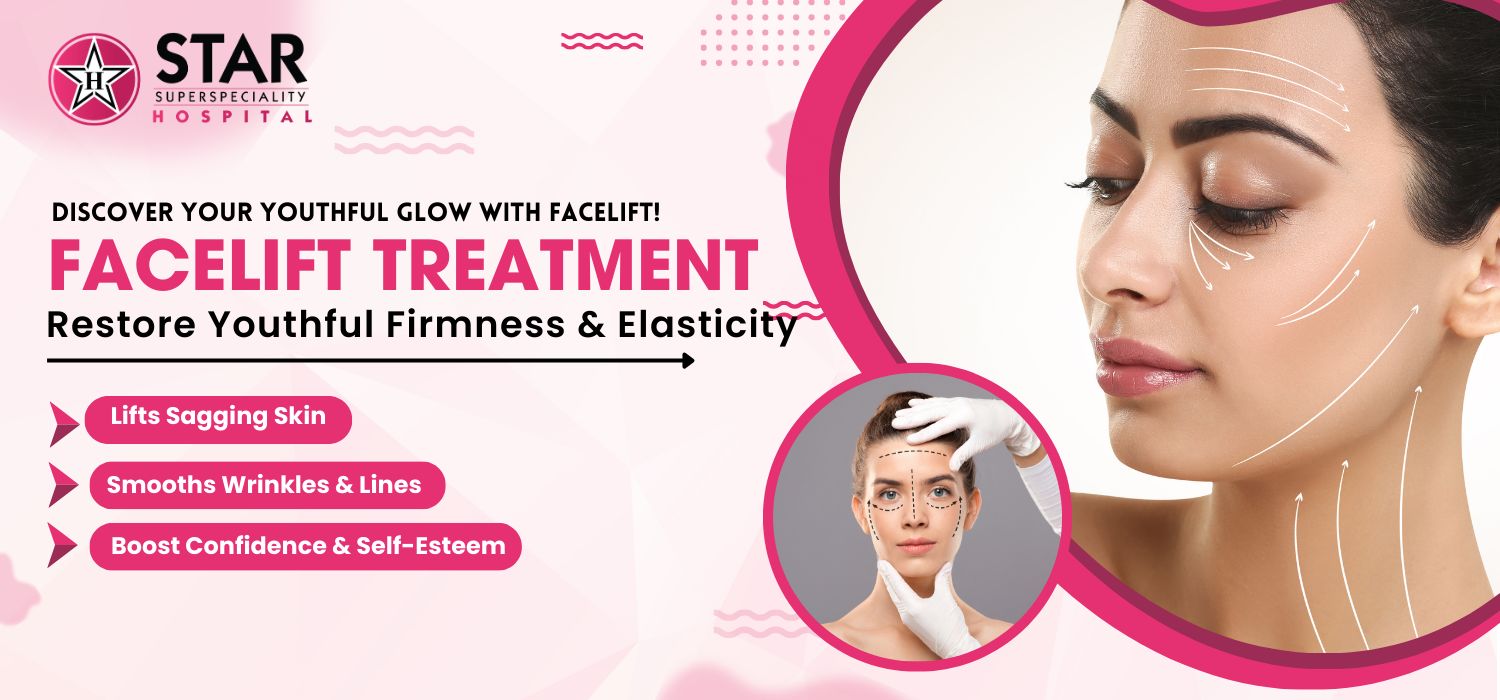 Face Lift Treatment in Jalandhar