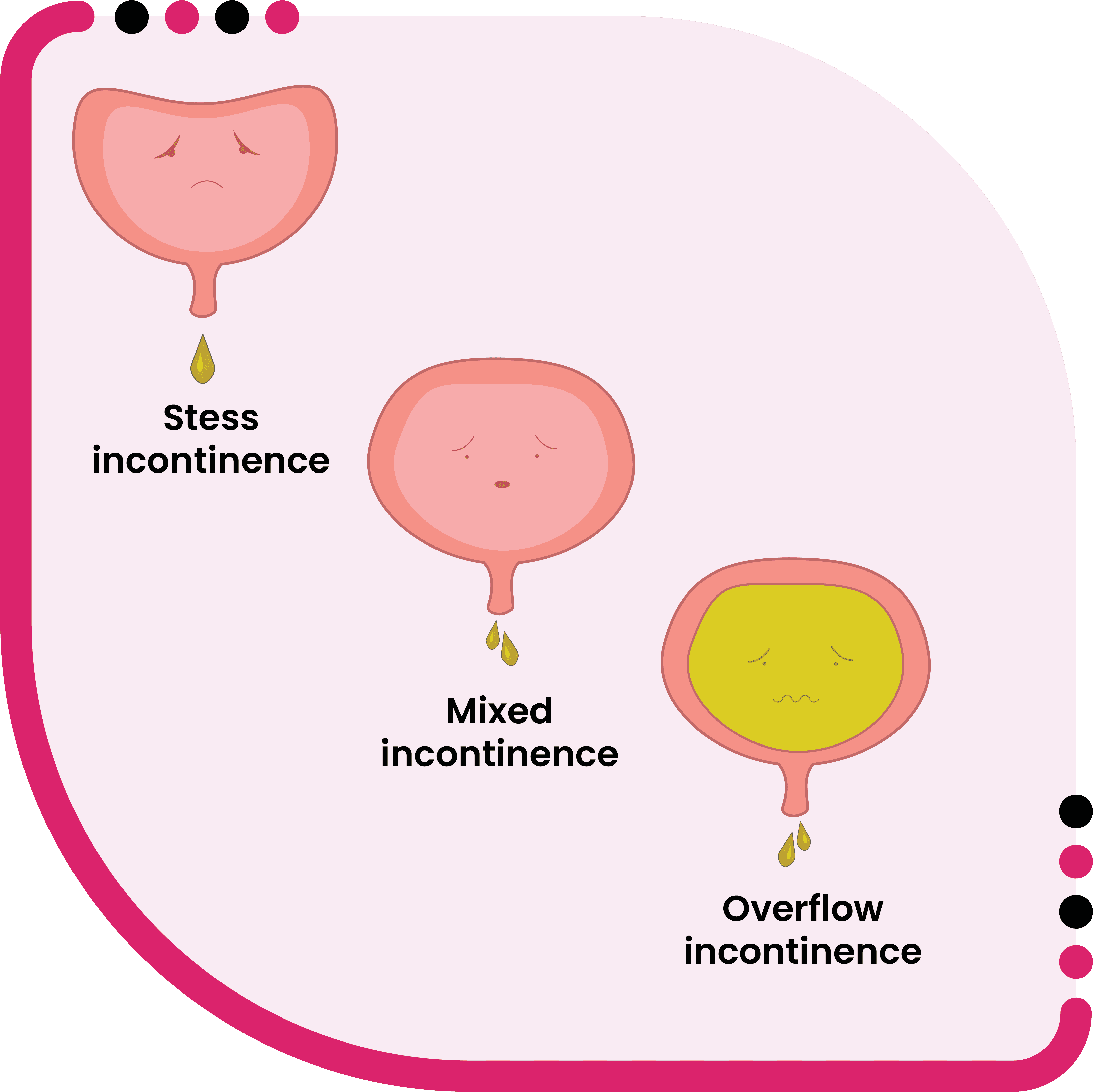 best urge incontinence treatment in Jalandhar