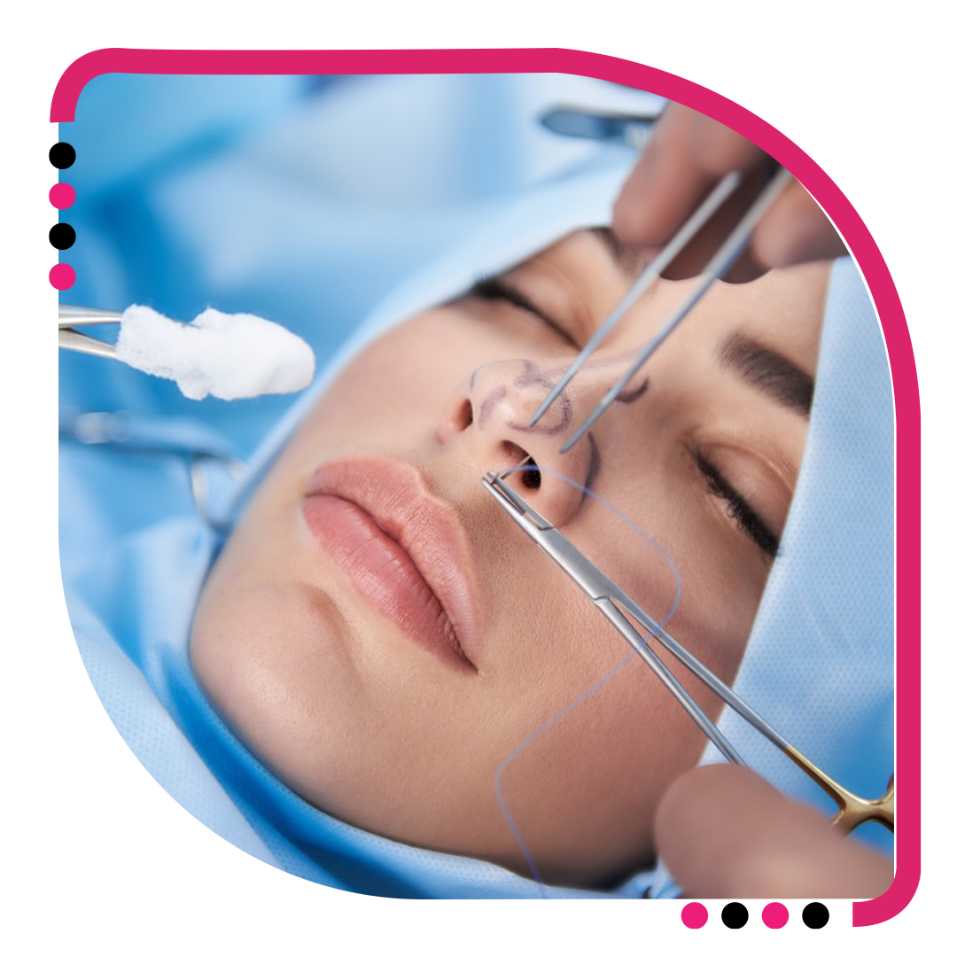 Rhinoplasty Surgery in Jalandhar