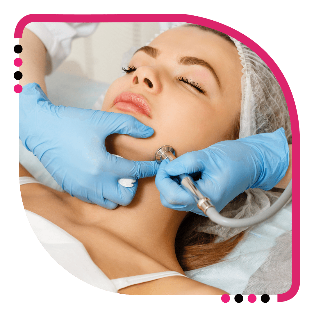 Best Dermabrasion Treatment In Jalandhar